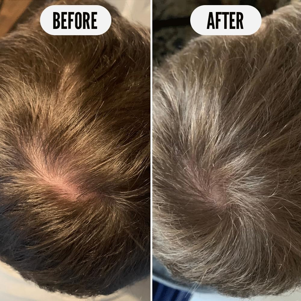 97% Natural Get Set Grow Hair Thickening Conditioner to Optimise Scalp Health, Stimulate Roots and Promote Hair Growth, with Organic Garden Pea Sprouts and Green Robusta Coffee Beans, 250Ml